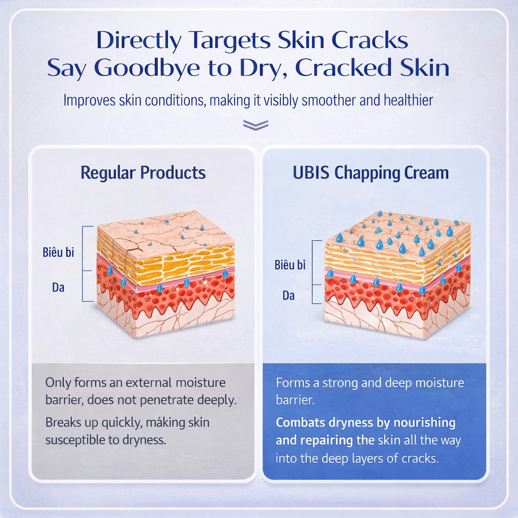 Ubis Chapping Cream Repair Dry Cracked Skin Moisturizer for Hands Feet ...