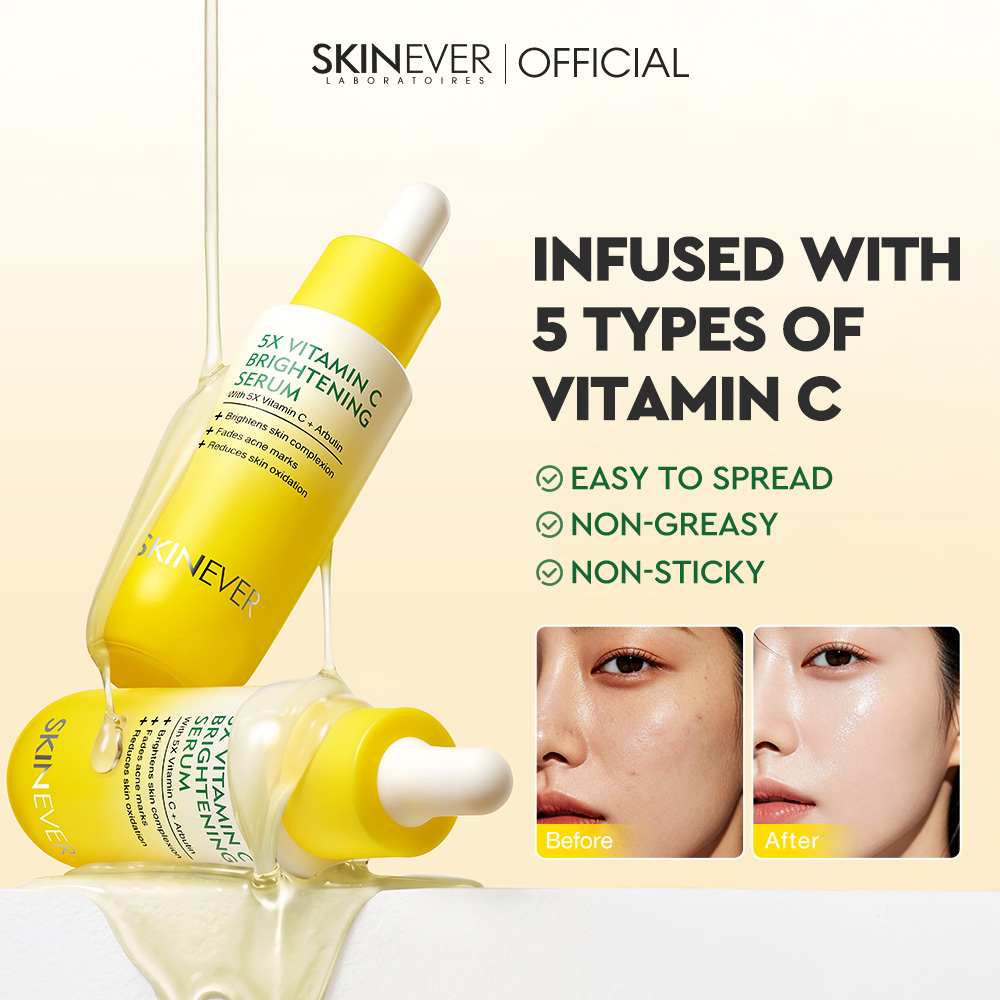 SKINEVER Vitamin C Set Whitening Facial Cleanser Moisturizing Toner ...