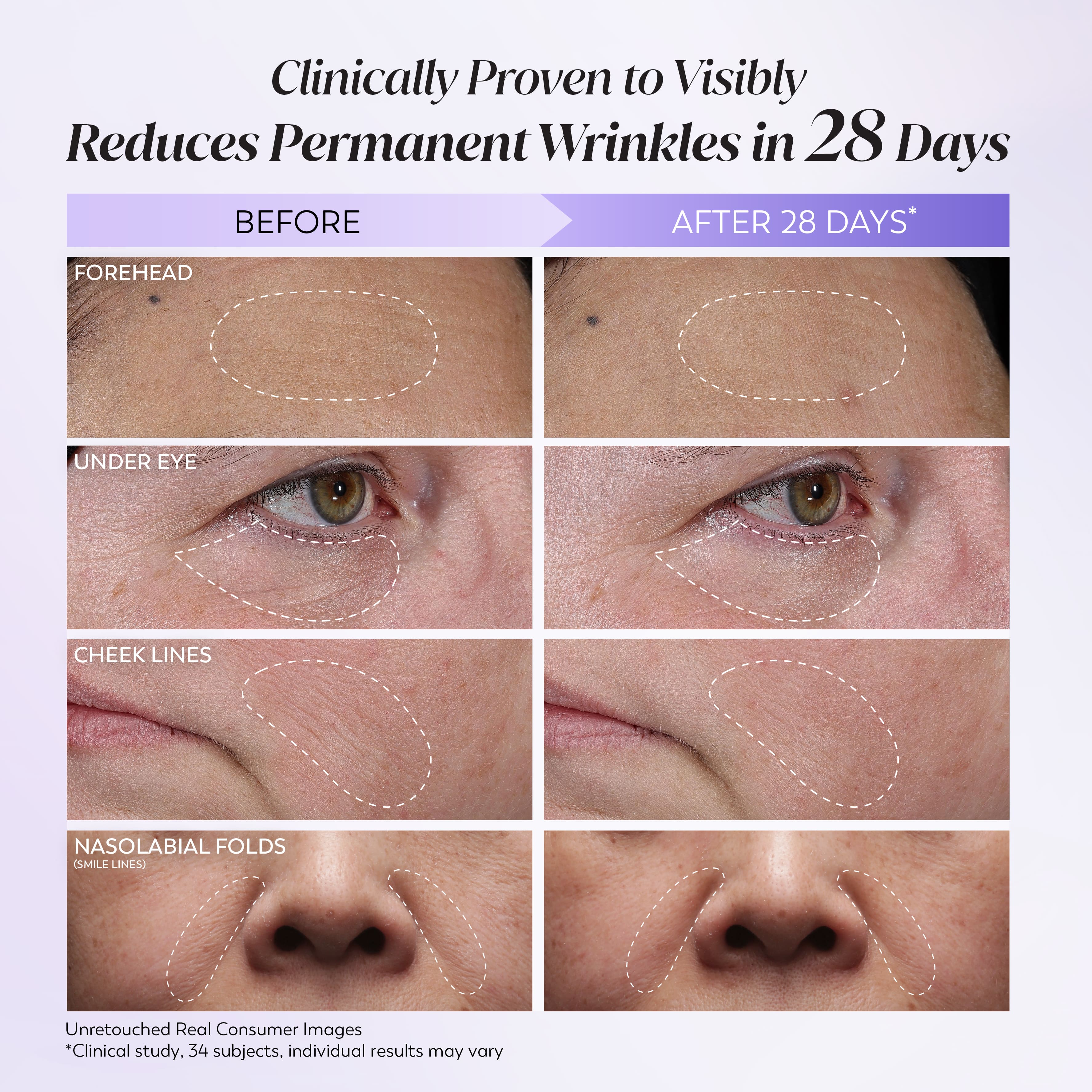 [NEW] Olay Retinol 24 Wrinkle Pen Overnight Wrinkle Concentrate Serum ...