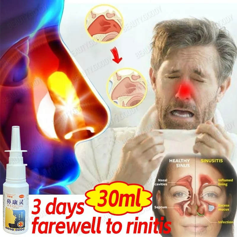 30ML Nasal Sprays Rhinitis Spray Sinusitis Spray Fast Effect Rhinitis