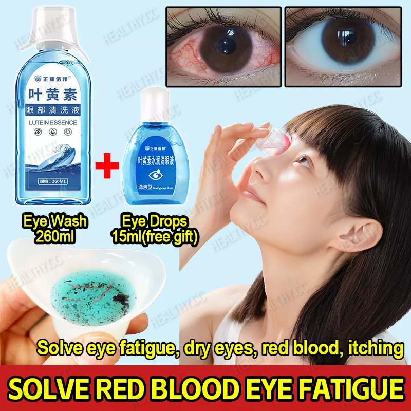 Eye Wash Solution Eye Wash Water 260ml+Eye Drops 15ml For Dry Eyes ...