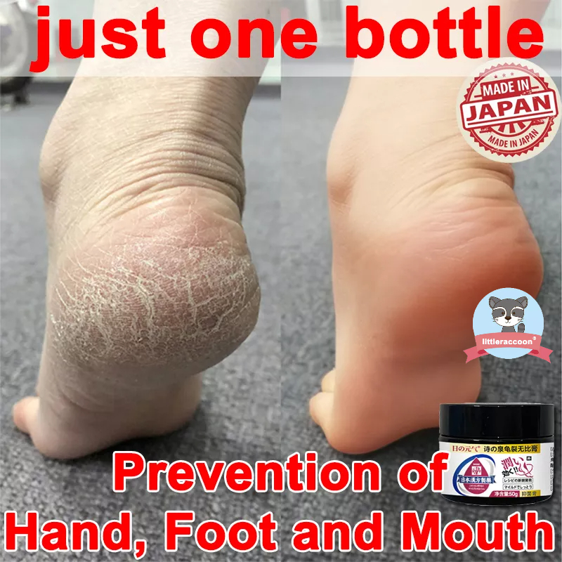 crack heel remover cream Remove Calluses Moisturize Feet Repair Dry and