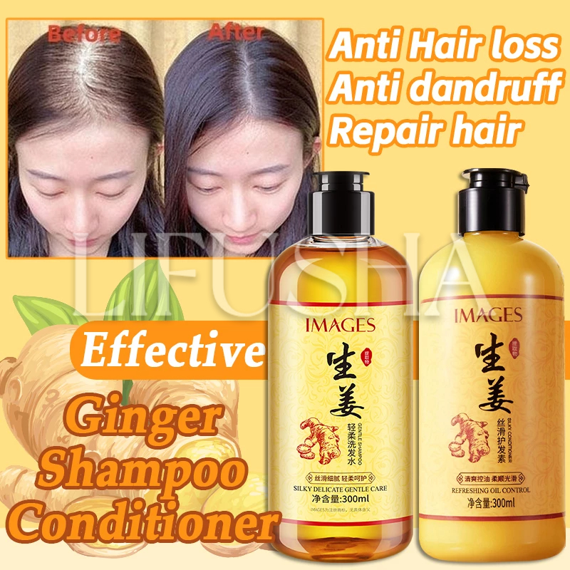 Ginger Hair Shampoo Fast Regrowth AntiHair Loss AntiDandruff Anti