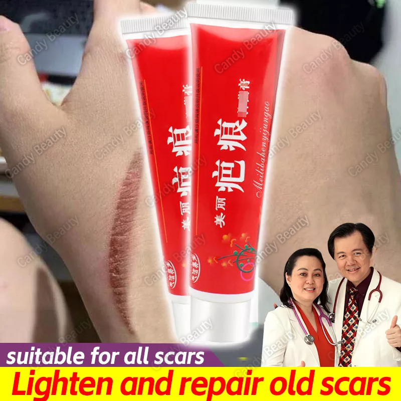 60g Scar Remover Cream Peklat Remover Stretch Marks Remover Repair Old Scar Acne Treatment