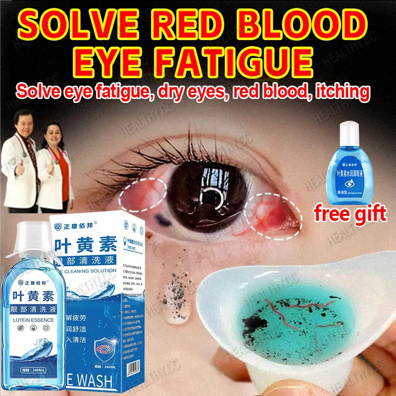 Eye Wash Solution Eye Wash Water 260ml+eye Drops 15ml For Dry Eyes 