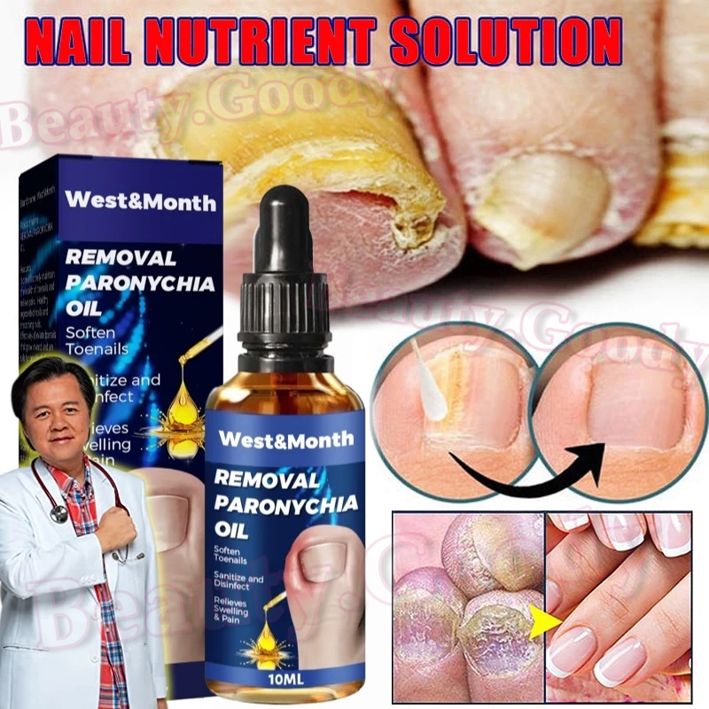 Nail Repair Treatment Oil Paronychia Relief Anti Fungal Infection Nail