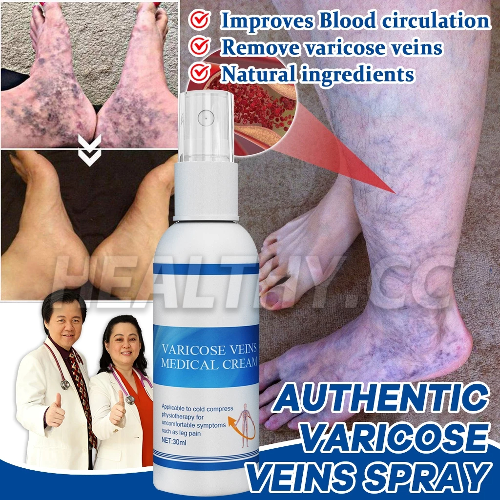 Varicose Veins Spray Effective Relief Veins Pain Remover Legs Spider ...