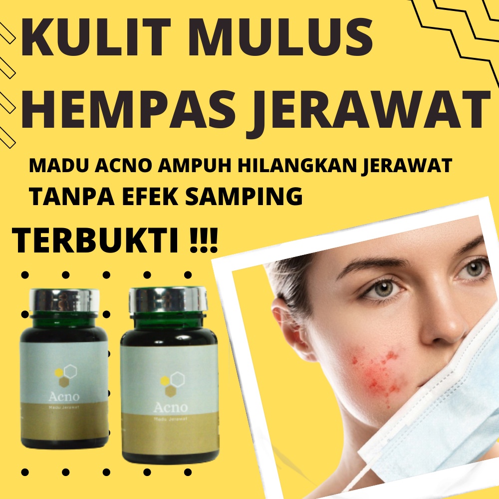 Acne Medicine - Easy Acne / ACNO Powder Acne | Shopee Philippines