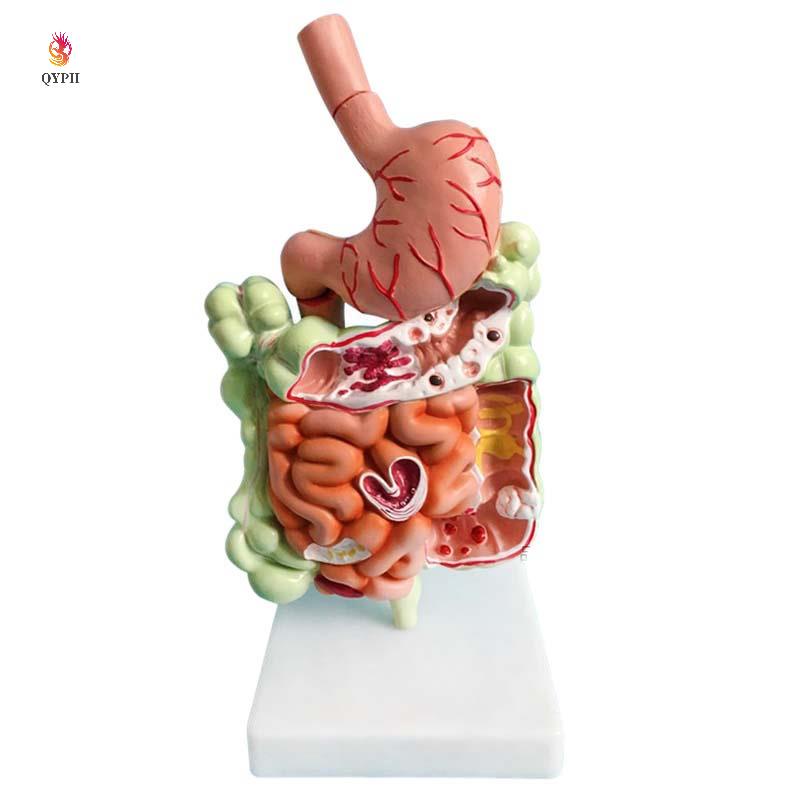 Human Digestive System Model Stomach Anatomy Large Intestine Cecum ...