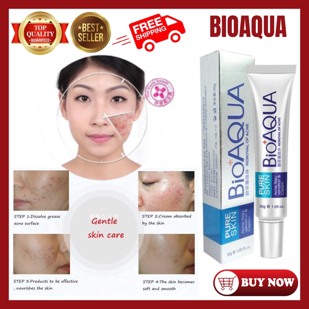 [100 Original Acne Removal Scar Marks Cream BIOAQUA] MEGASALE Acne