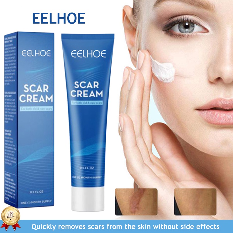 Scar Remover Cream Skin Repair Fade Scar Cream Burns Burns Pox Marks