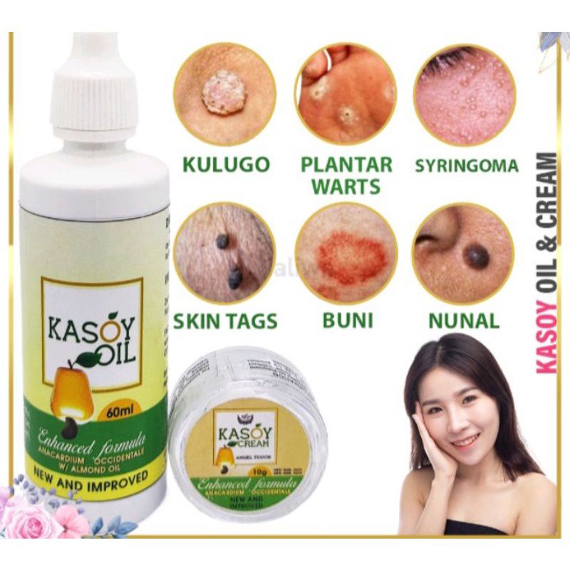 Authentic Kasoy Oil 60ml | Shopee Philippines