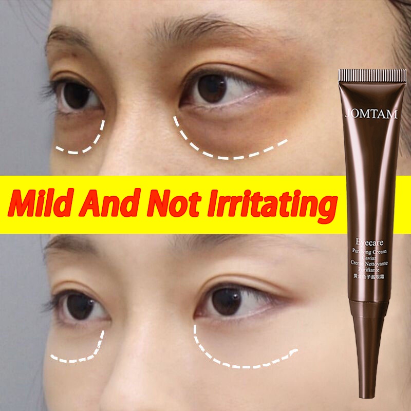 DSIUAN Eye Cream Remove Dark Circle Cream Moisturizing AntiAging