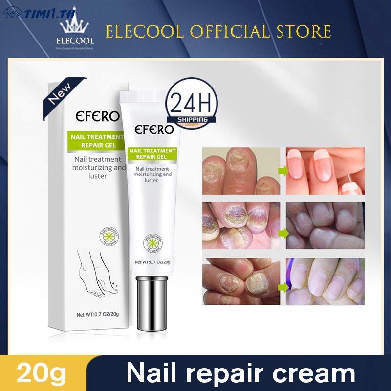 New EFERO Nail Repair Cream to exfoliate dead skin to repair toenail fungus Shopee Philippines