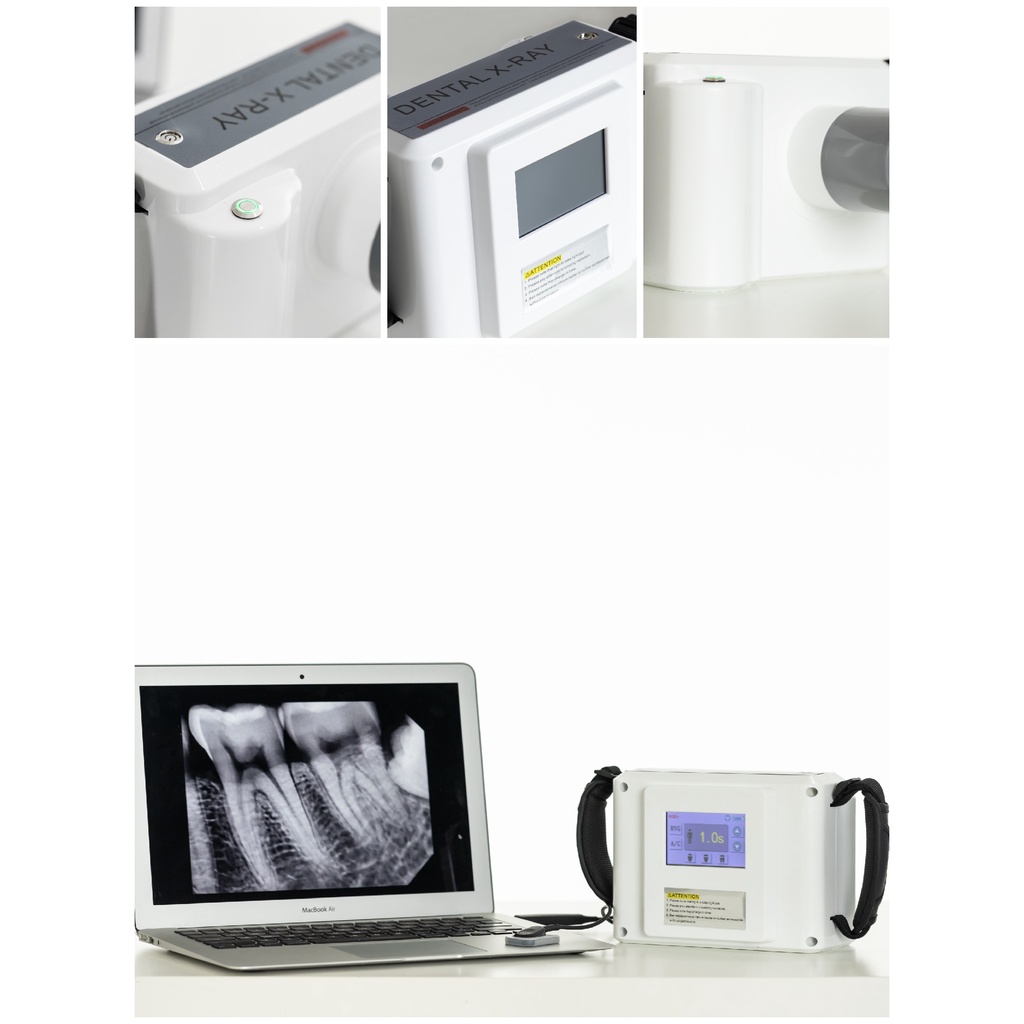 Dental x ray Unit xray Portable Machine Dental xray Equipment Opg