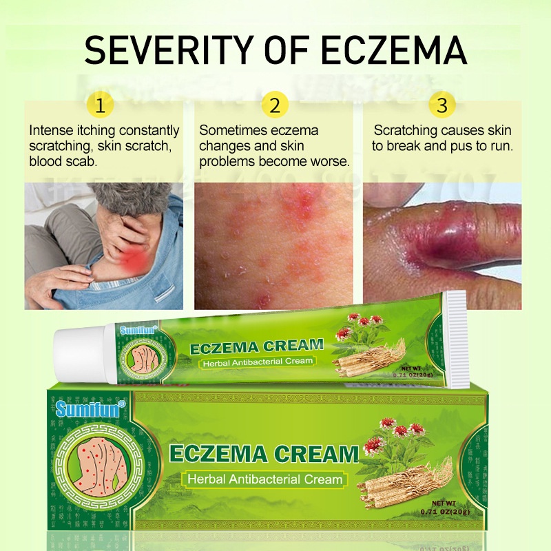 Sumifun Eczema Cream Gamot Sa Kati Kati Sa Balat Ointment For Itchy Skin And Allergy Shopee 7016