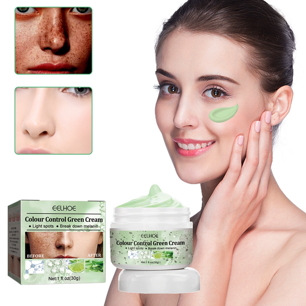 Whitening Dark Spots Fading Cream Remove Freckle Fade Pimple Scars
