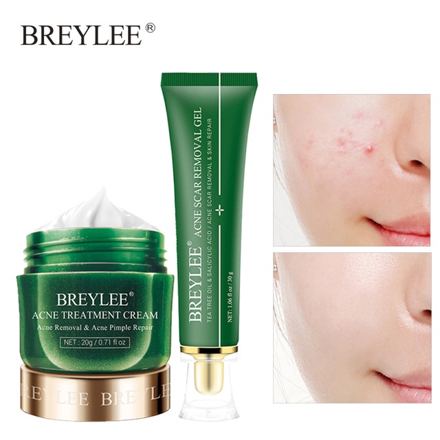 BREYLEE 30g Effective Weakening Acne Scar Removal Gel Fade Acne Remove