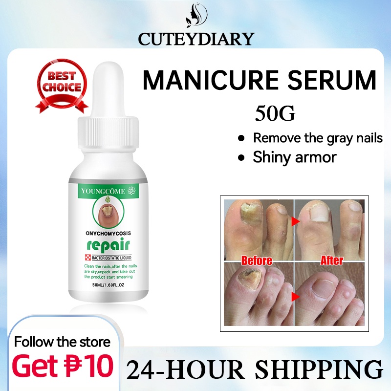 Youngcome Fungal Nail Treatment Nail Repair Essence Serum Remover Onychomycosis Nourishing