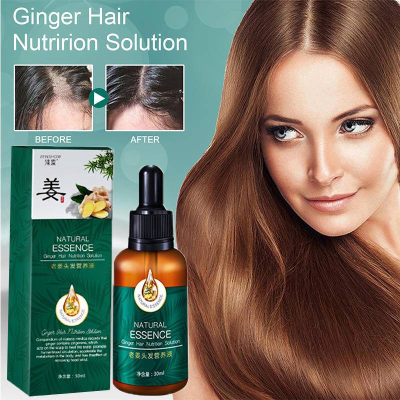 Hair Growth Essence Ginger Hair Grower Anti-Lose Natural Plant Extract ...