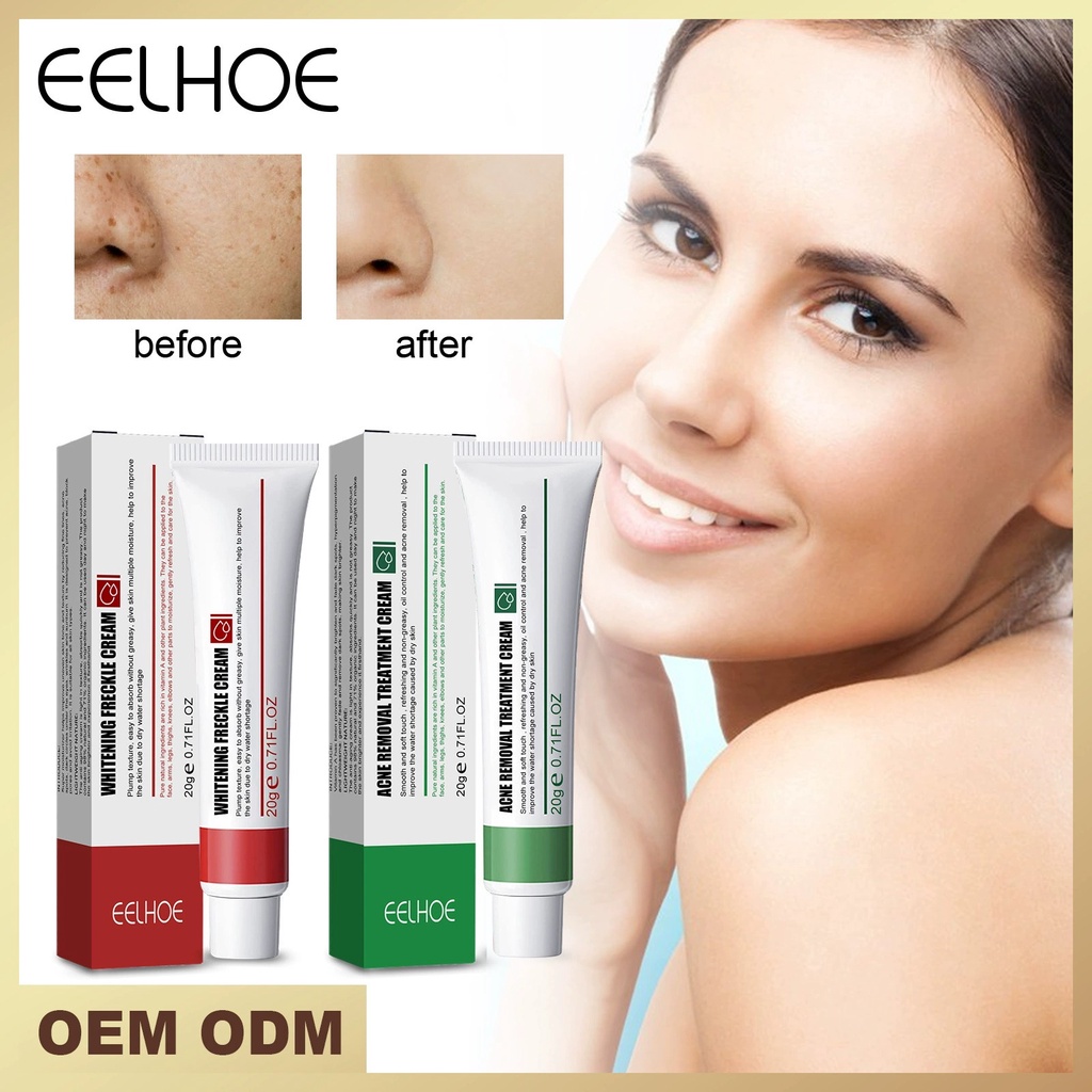 EELHOE WHITENING FRECKLE CREAM (20g) AND ACNE REMOVAL TREATMENT CREAM