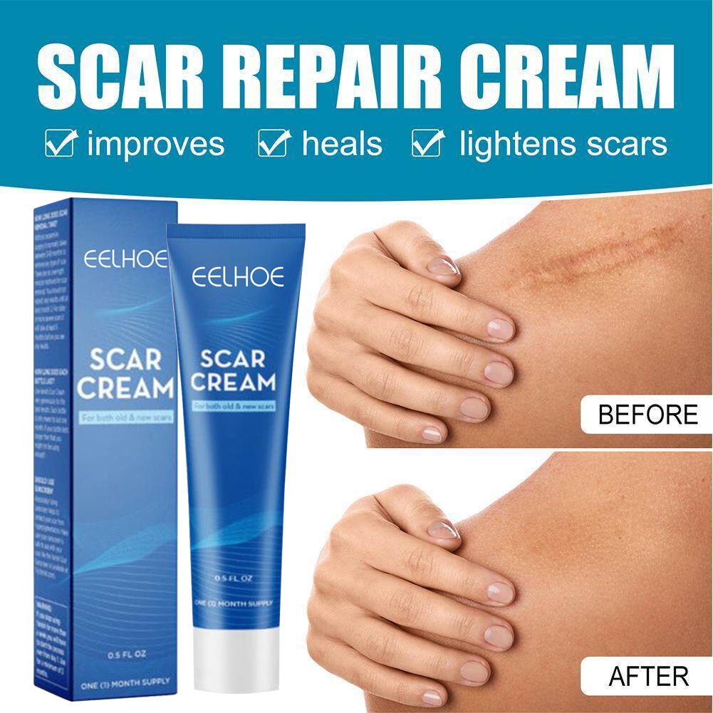 contractubex scar gel original Scar Remover Cream Scar Removal Cream