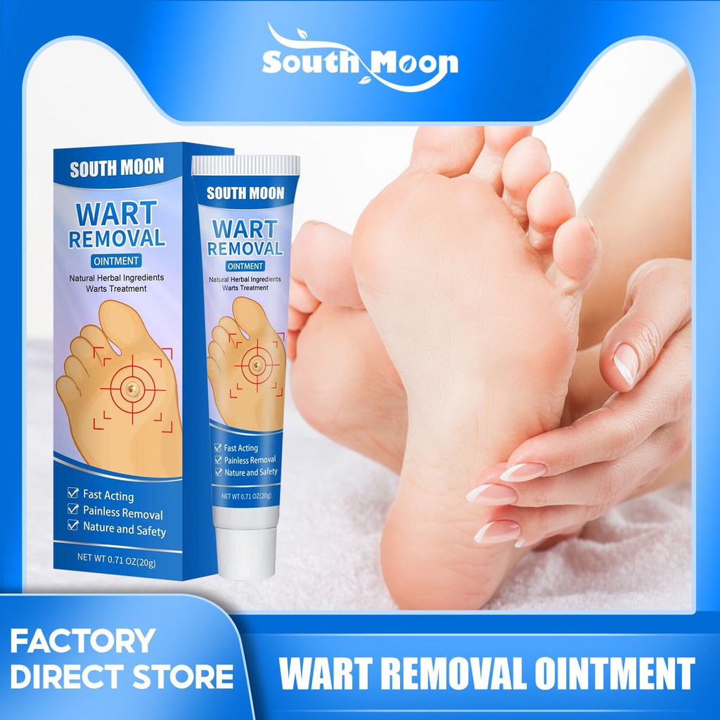 20g South Moon Corn Peeling Cream Plantar Wart Remover Rapid Removal Of