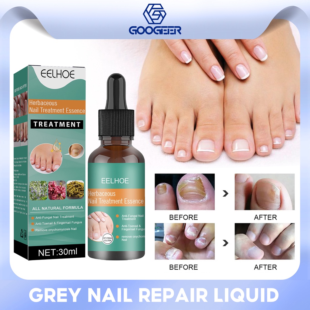 EELHOE Herbaceous Nails Repairing Serum Onychomycosis Paronychia Anti