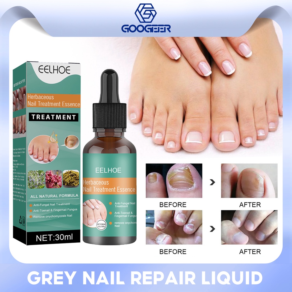 Eelhoe Herbaceous Nails Repairing Serum Onychomycosis Paronychia Anti 