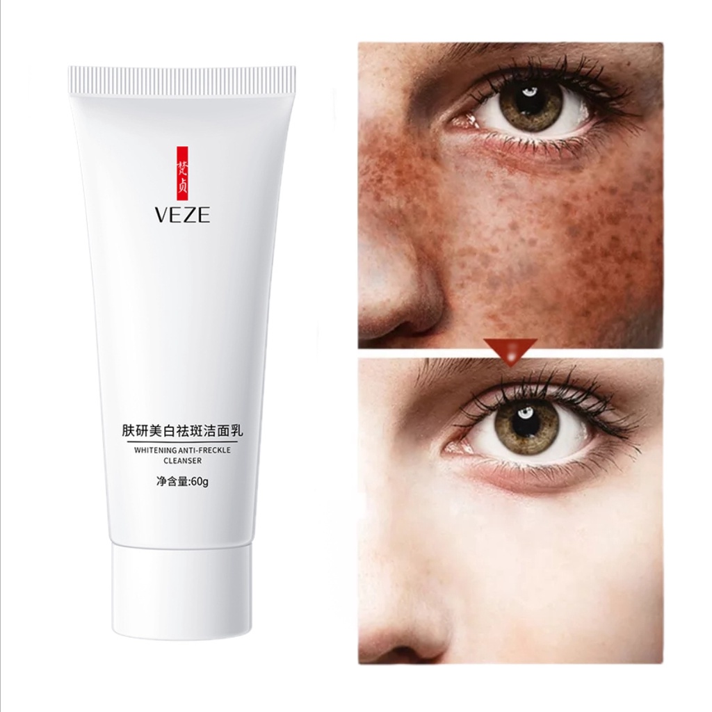 Whitening Freckle Facial Cleanser Remove Melasma Dark Spots Niacinamide