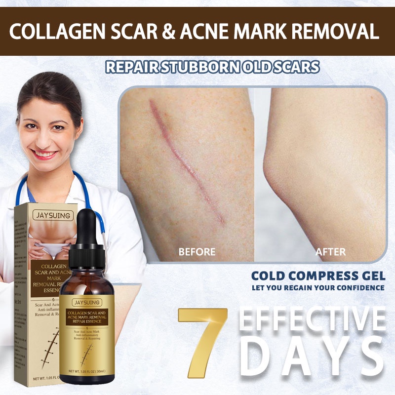 Scar Remove Repair Skin Essential Oil Collagen Scar And Acne Mark Removal Repair Essence Remove