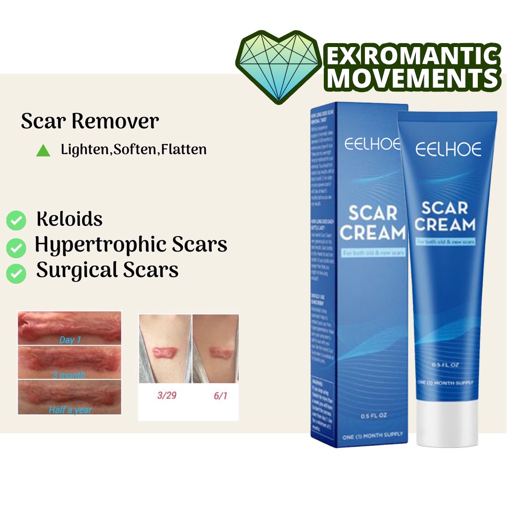 Pangtanggal Ng Peklat Scar Remover Scar Removal Cream Scarminator Cream 