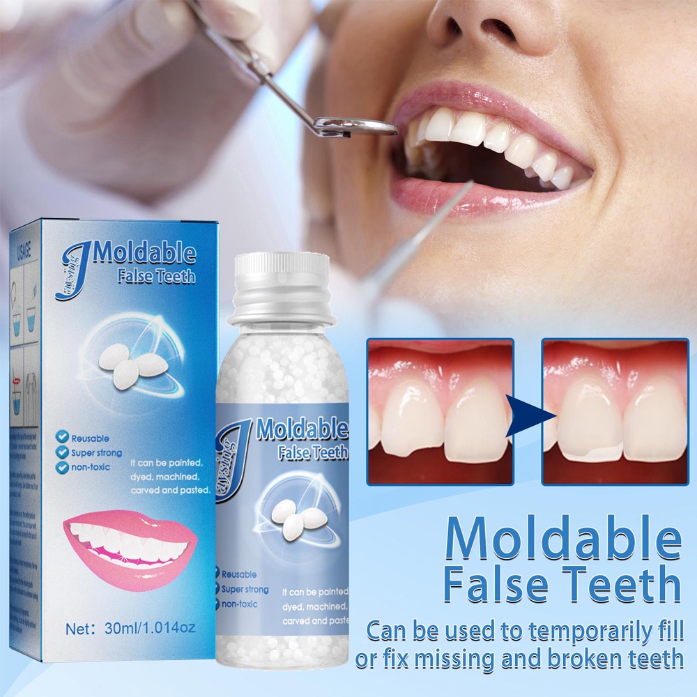 30ML Temporary Tooth Repair Kit Teeth and Gaps Moldable Falseteeth