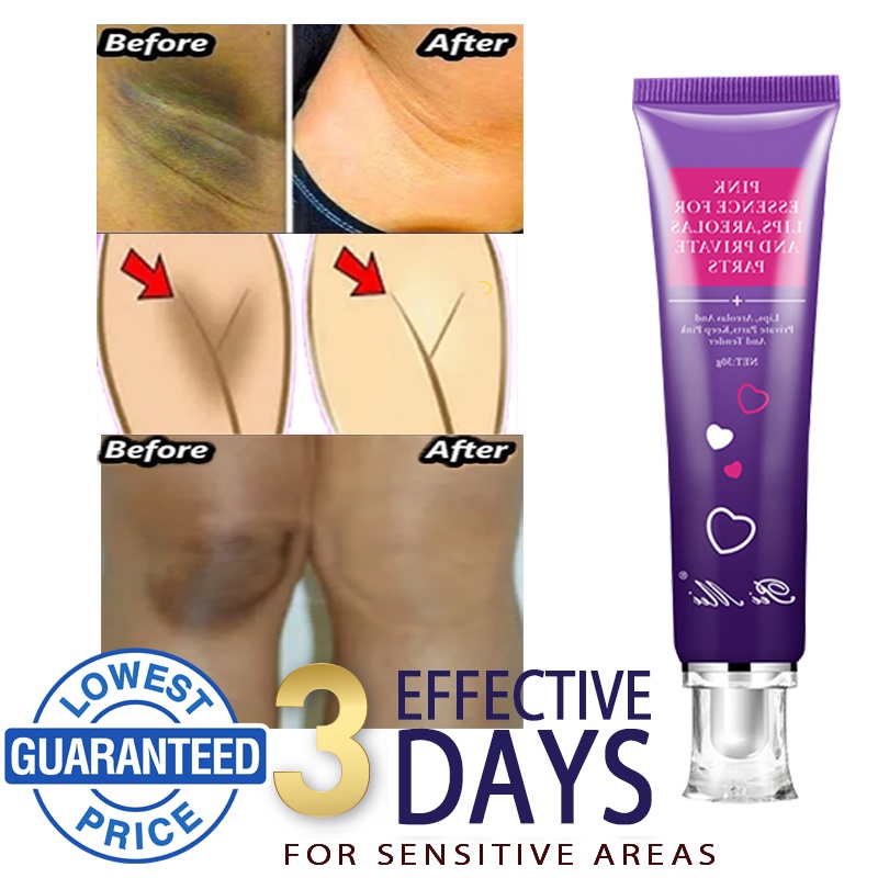 underarm whitening cream set pampaputi ng kilikili for face for