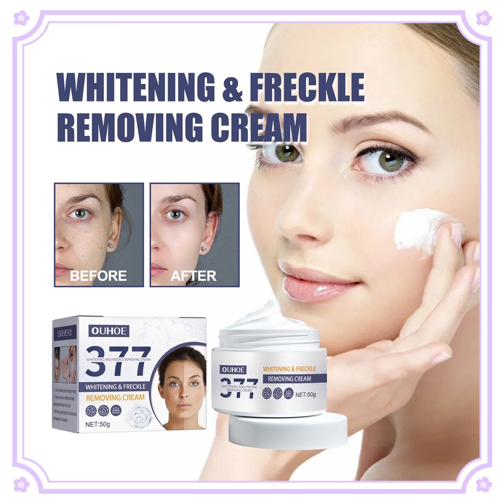 OUHOE 50g Effective Whitening Freckle Cream Fade Dark Spot Anti Freckle ...