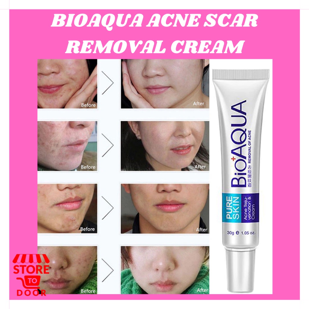 ORIGINAL BIOAQUA ANTI ACNE & PIMPLES REMOVAL REJUVENATION CREAM