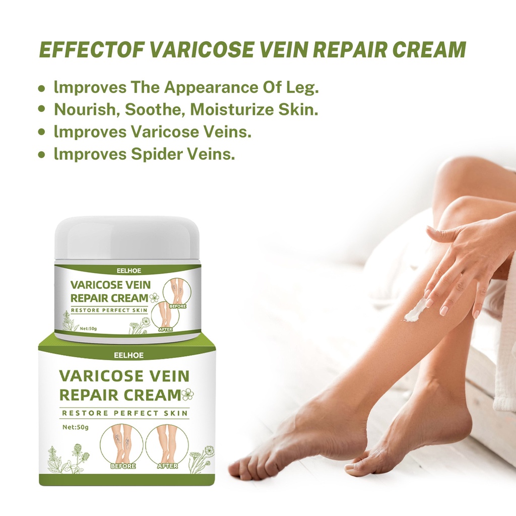 ♕Eelhoe Varicose Vein Cream Swelling Earthworm Leg Care Varicose Venous ...