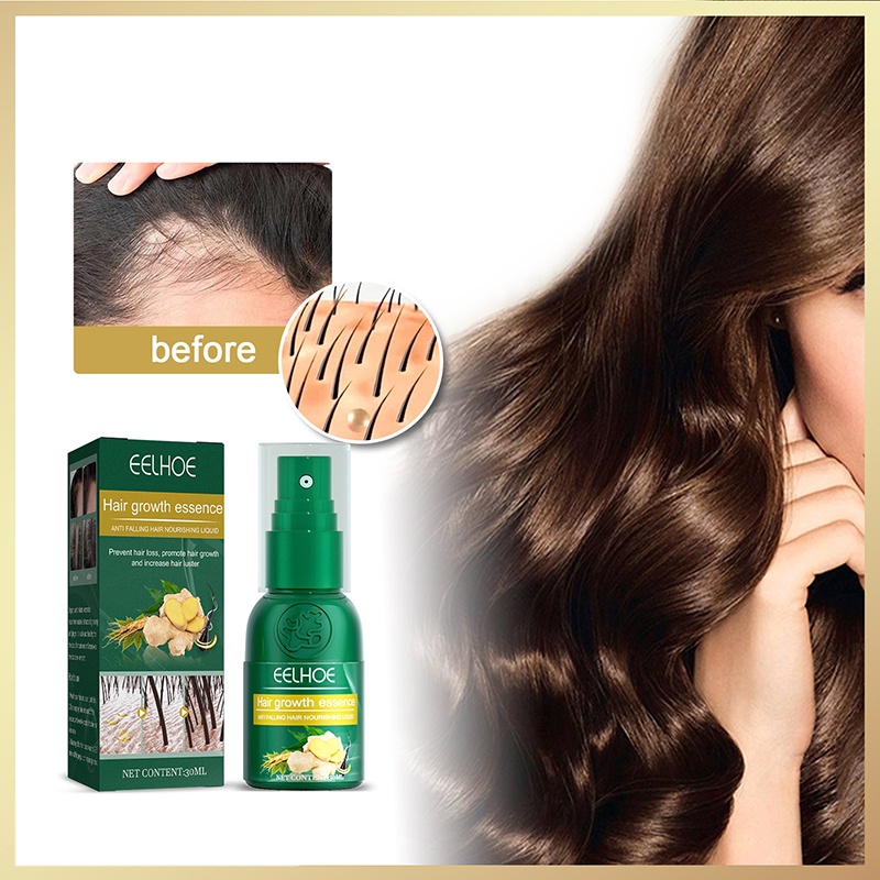 Ginger Hair Growth Sprays Natural Anti Hair Loss Serum Prevent Baldness