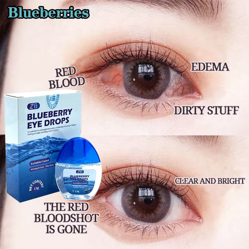 【COD】Blueberry Eye Drops Itchy Eyes Eye Drops Dry Eyes