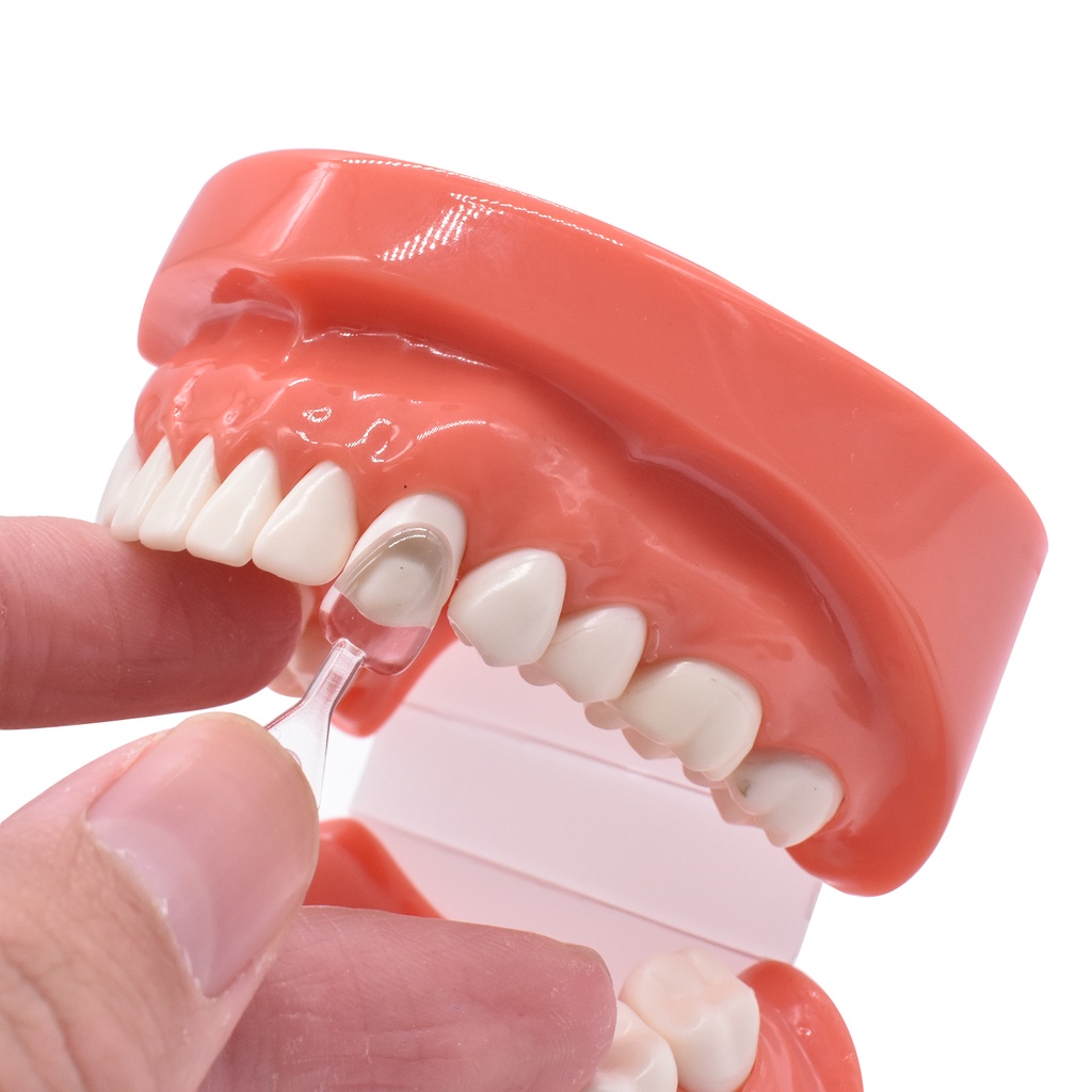 Dental Veneers Mould Kit posite Resin Mold Light Cure Teeth Partner