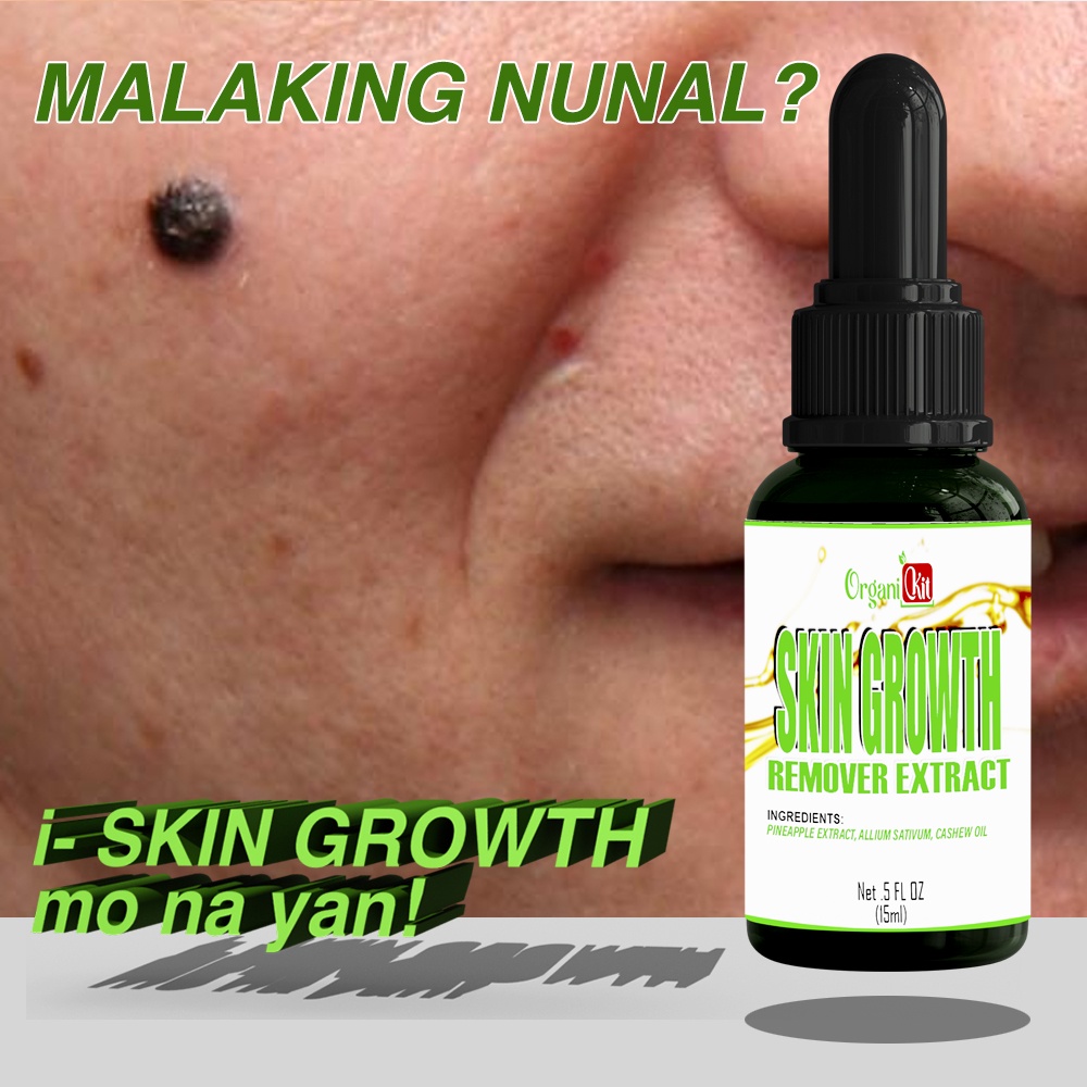 SKIN GROWTH REMOVER ( OIL ) / Kulugo remover / Warts removal / Milia