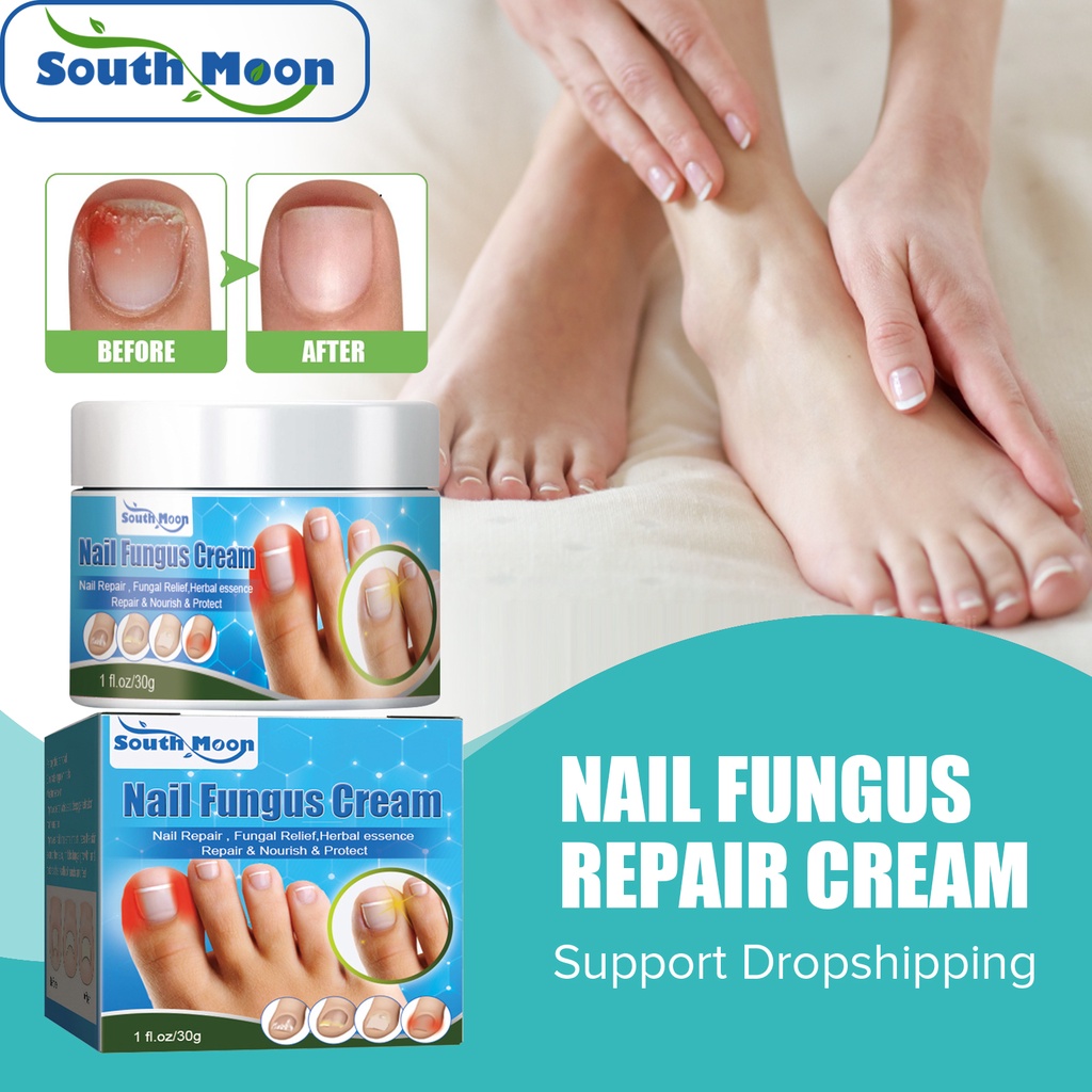 South Moon 30g Nail Care Cream Herbal Anti Fungus Onychomycosis 