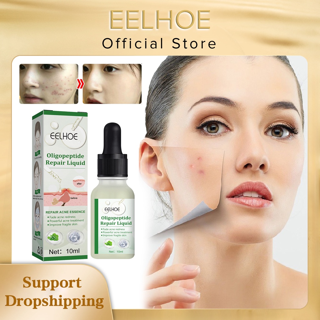 EELHOE Acne Treatment Serum Repair Pimples Lighten Scar Remove Redness