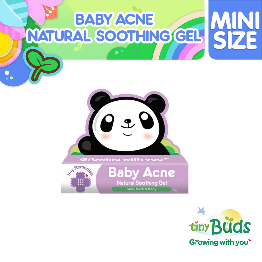 Tiny Buds Mini Baby Acne Natural Soothing Gel Shopee Philippines