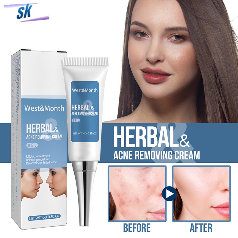 SK Acne Remover Cream Face Acne Pimple Treatment Skin Repair 10g Acne