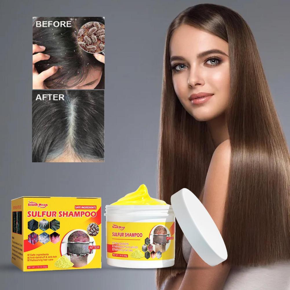 Sulfur Soap Psoriasis Eczema Ointment Seborrhea Eczema Bath Shampoo