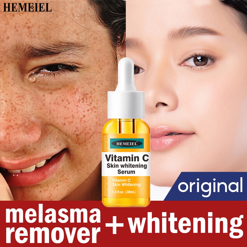 HEMEIEL Vitamin C Serum /Melasma Cream Pekas Remover /Dark Spots
