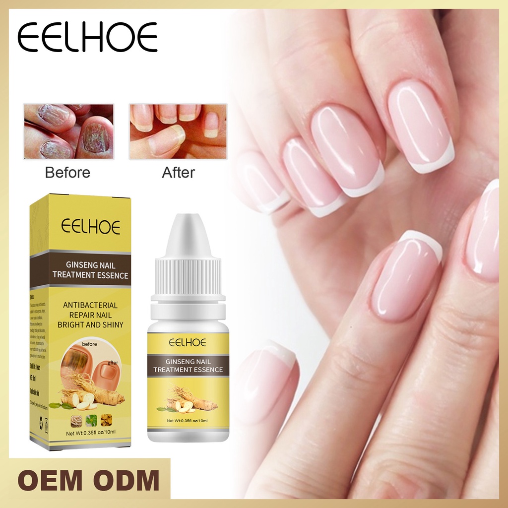 Eelhoe Nail Fungal Treatment Feet Care Toe Fungus Removal Gel Repai