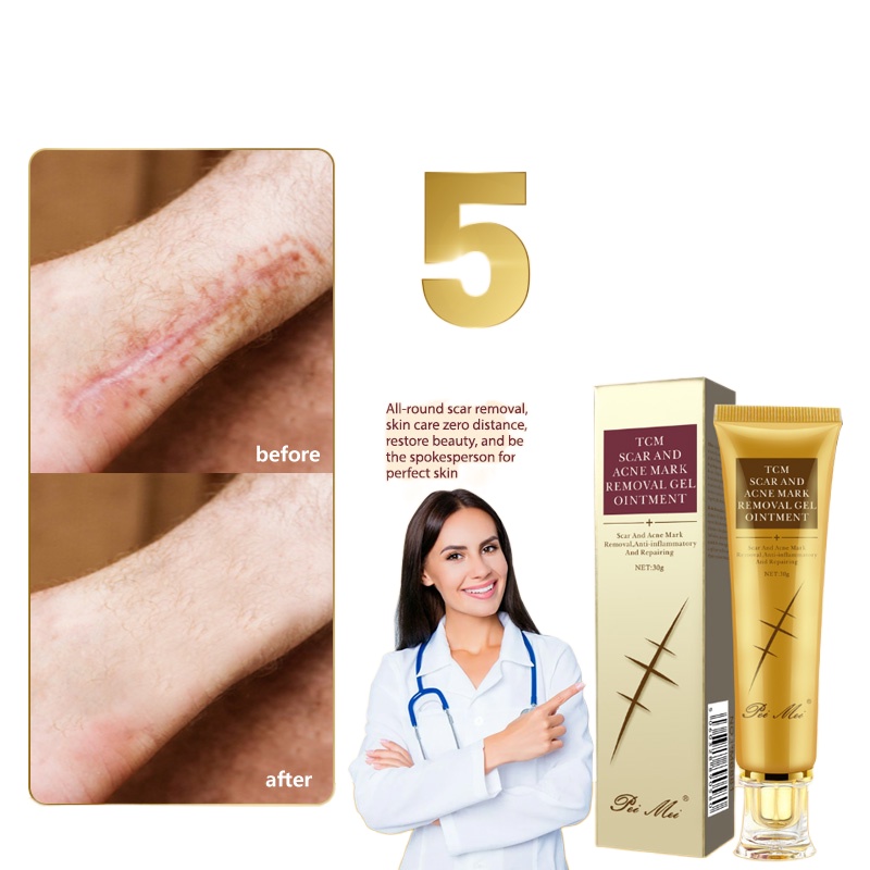 OKADY Fix scar removal cream original scar remover for old scar scars