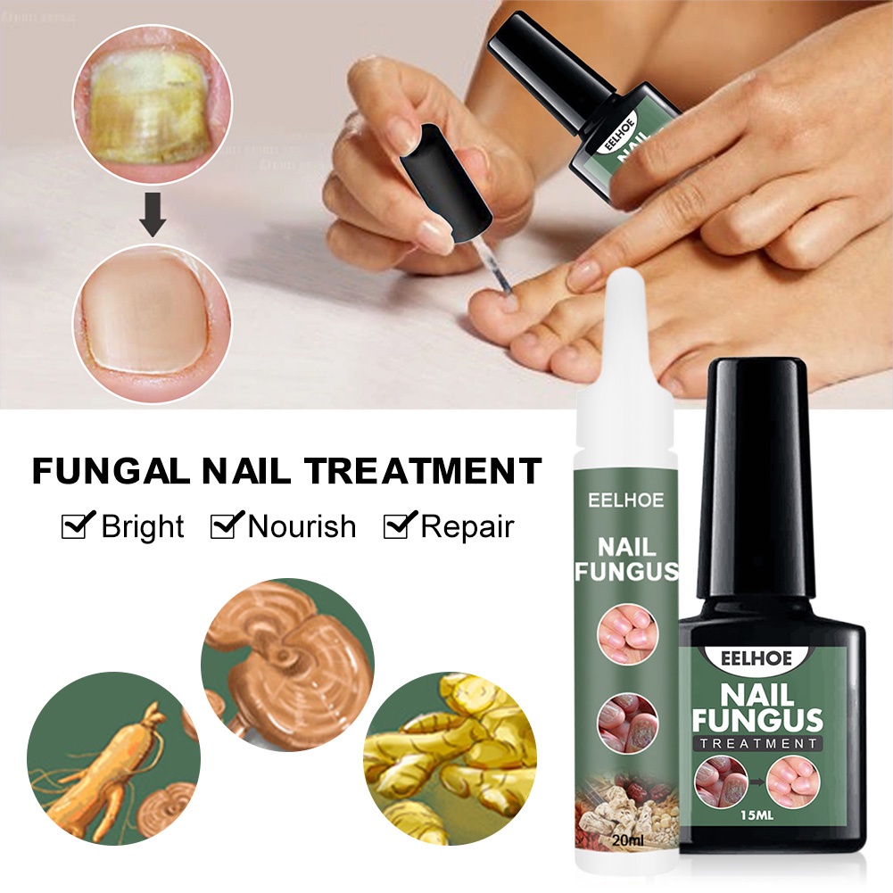 Nail Fungus Treatment Antifungal Solution Promote New Growth Of Nails